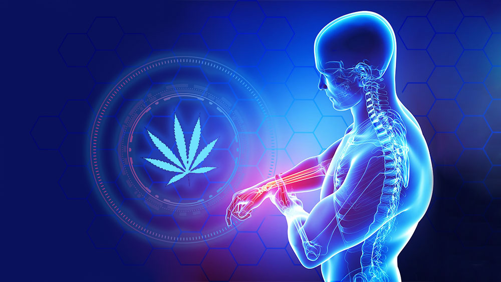 Marijuana for arthritis