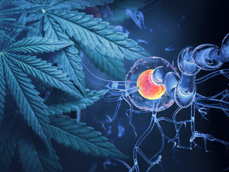 How Good Is Cannabis for Multiple Sclerosis (MS) Spasticity?