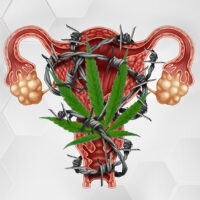 Can Cannabis Be Used To Treat Polycystic Ovary Syndrome (PCOS)?
