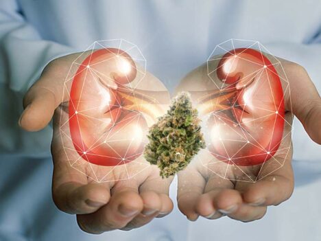 Marijuana and Kidney Disease: A Scientific Overview