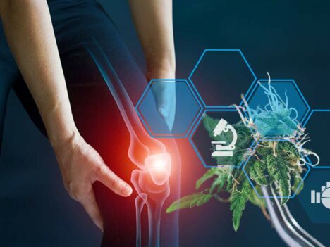 Cannabinoids and Inflammation: What Does the Current Research Say?