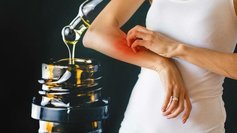 CBD in a jar and an inflamed part of a woman's arm.