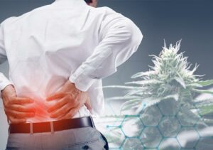 CBD for Sciatica: A Look Into the Potential Treatment for Chronic Pain